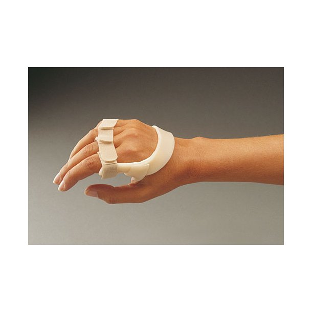 Ulnar drift splint højre